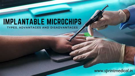 how to implant rfid chip in human|Microchip implant (human) .